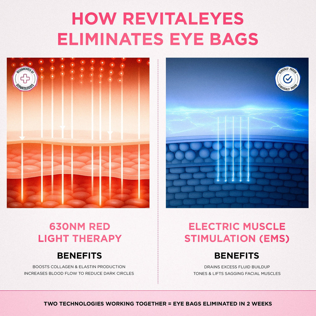 RevitalEyes