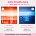 RevitalEyes