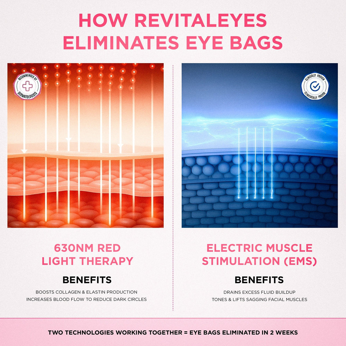 RevitalEyes