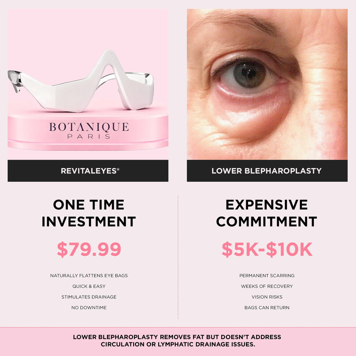RevitalEyes