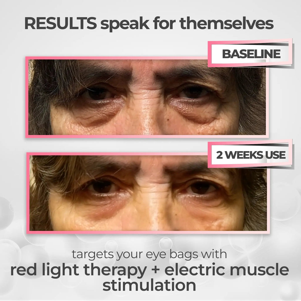 RevitalEyes