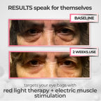 RevitalEyes