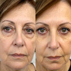 RevitalEyes