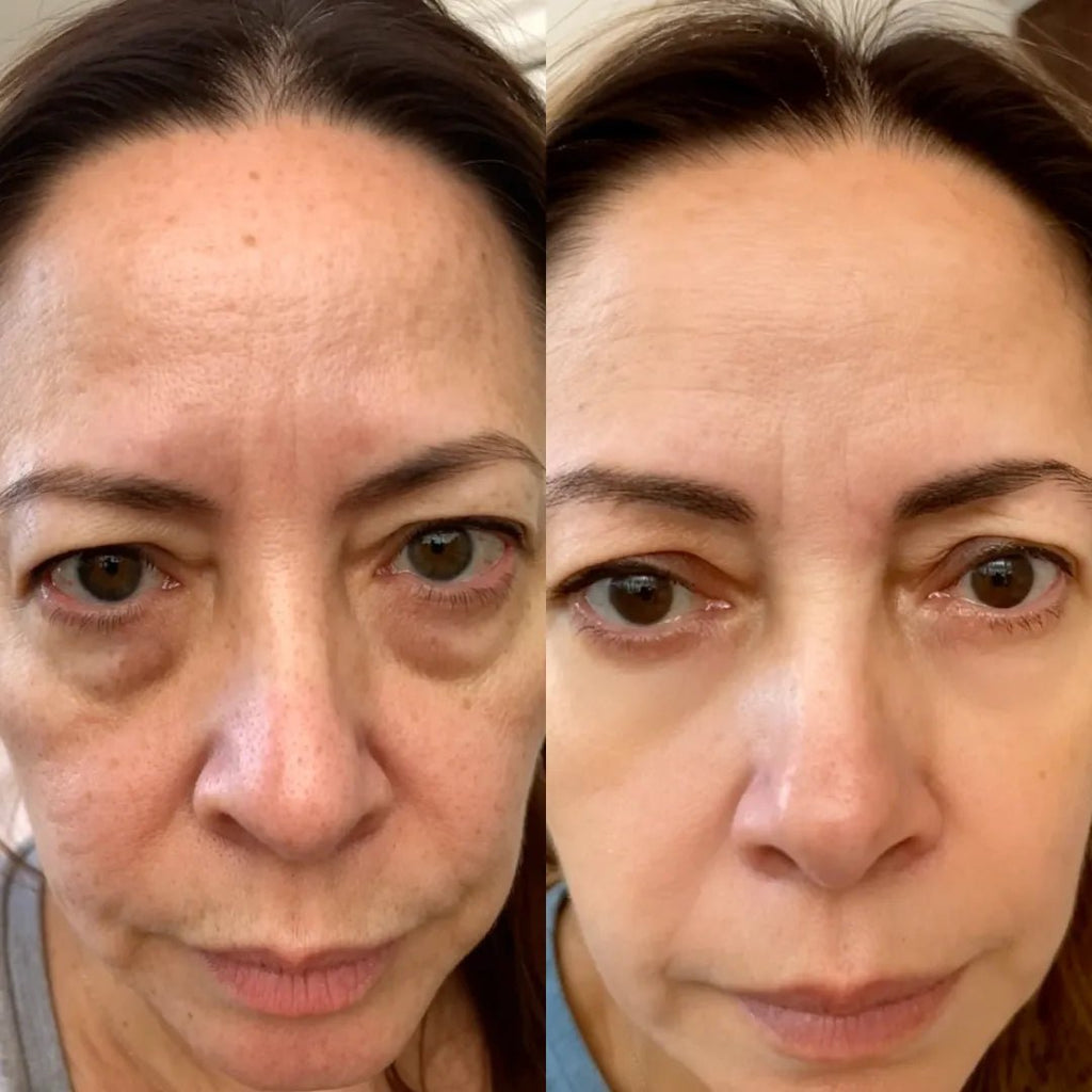 RevitalEyes