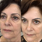 RevitalEyes