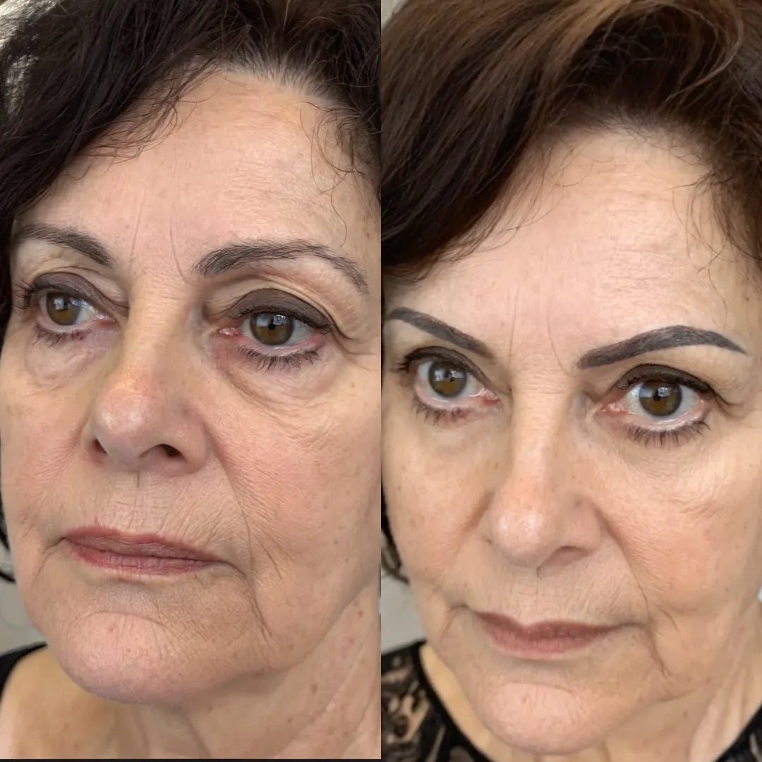 RevitalEyes