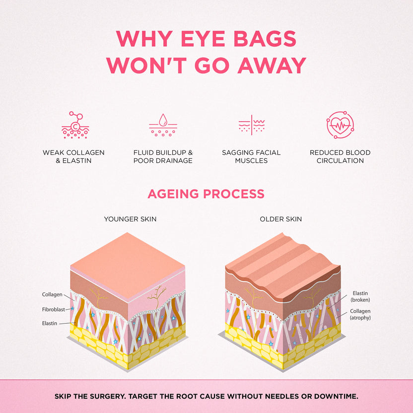 RevitalEyes
